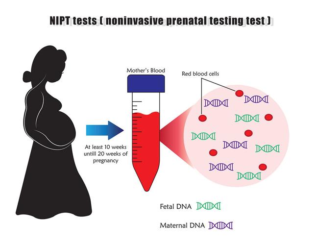 The NIPT test is a non-invasive prenatal test for pregnant women that estimates the risk of a fetus having some genetic disorder such as Down syndrome, Patau's Syndrome, Edward's Syndrome, etc.